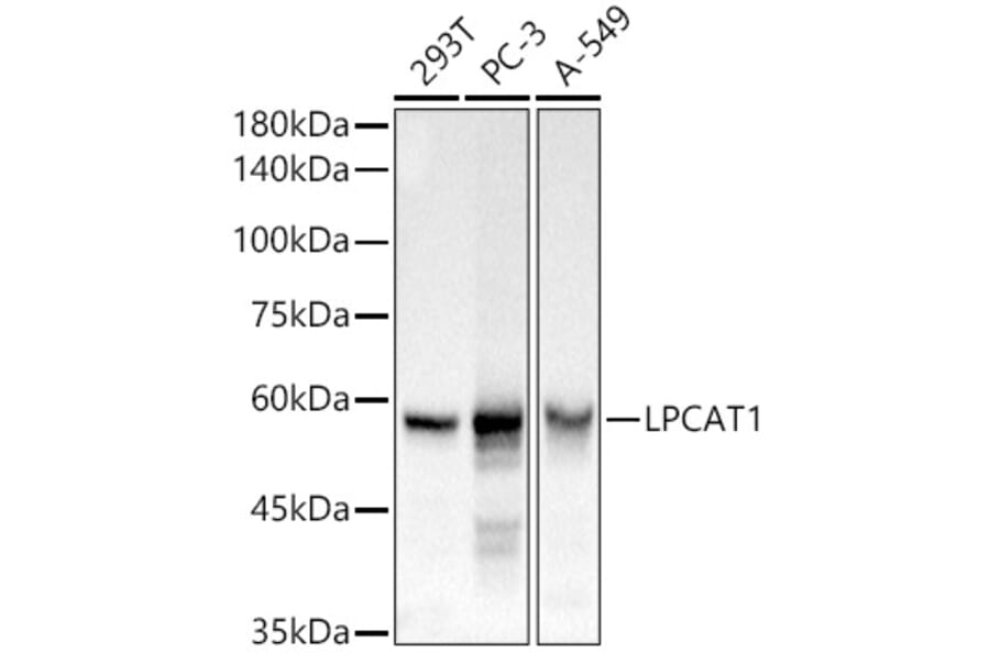 Western Blot - Anti-LPCAT1 Antibody (A11800) - Antibodies.com