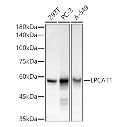 Western Blot - Anti-LPCAT1 Antibody (A11800) - Antibodies.com