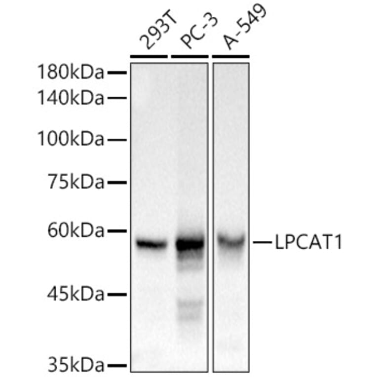 Western Blot - Anti-LPCAT1 Antibody (A11800) - Antibodies.com
