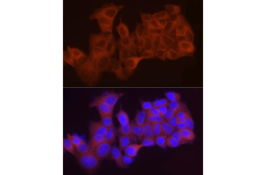 Immunofluorescence - Anti-LPCAT1 Antibody (A11800) - Antibodies.com