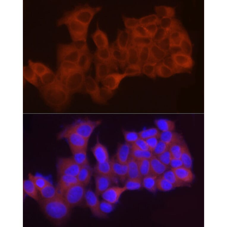 Immunofluorescence - Anti-LPCAT1 Antibody (A11800) - Antibodies.com