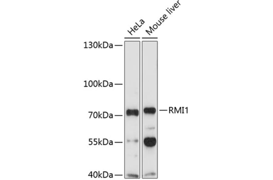 Western Blot - Anti-BLAP75 Antibody (A11801) - Antibodies.com