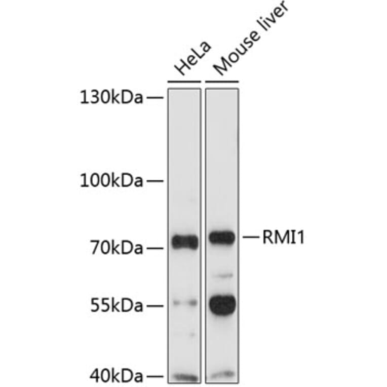 Western Blot - Anti-BLAP75 Antibody (A11801) - Antibodies.com