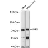Western Blot - Anti-BLAP75 Antibody (A11801) - Antibodies.com