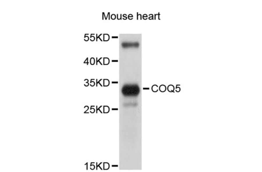 Western Blot - Anti-COQ5 Antibody (A5050) - Antibodies.com