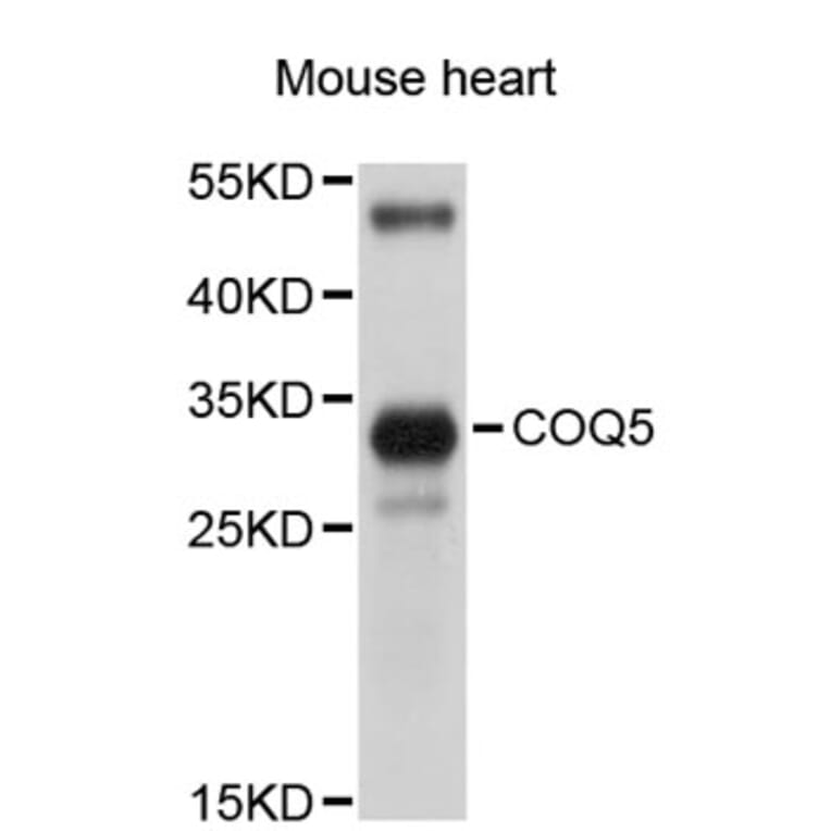 Western Blot - Anti-COQ5 Antibody (A5050) - Antibodies.com