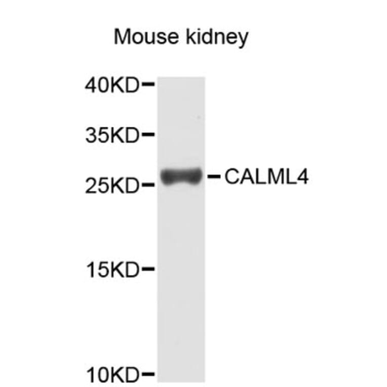 Western Blot - Anti-CALML4 Antibody (A5086) - Antibodies.com