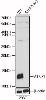Western blot analysis of extracts of various cell lines, using Anti-ATPIF1 Antibody (A5099) at 1:1,000 dilution.
Secondary antibody: Goat Anti-Rabbit IgG (H+L) (HRP) (AS014) at 1:10,000 dilution.
Lysates / proteins: 25µg per lane.
Blocking buffer: 3% non-fat dry milk in TBST.
Detection: ECL Basic Kit (RM00020).
Exposure time: 90s.