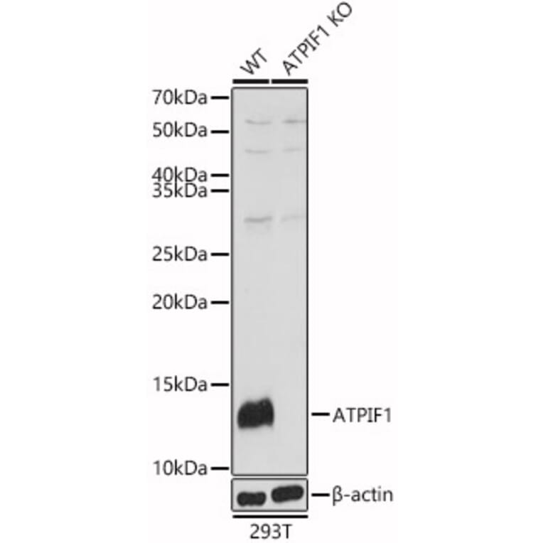 Western Blot - Anti-ATPase Inhibitory Factor 1/IF1 Antibody (A11808) - Antibodies.com