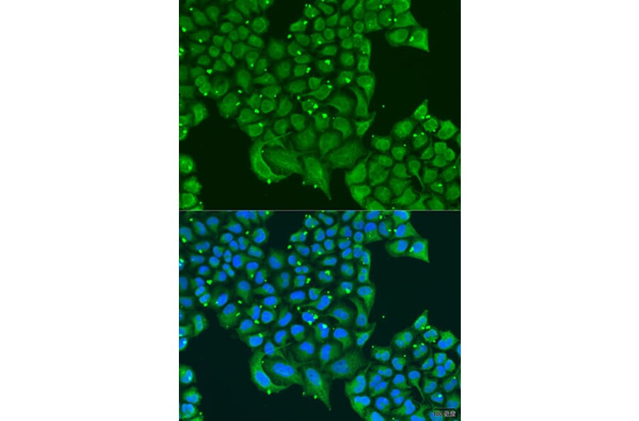 Immunofluorescence - Anti-ATPase Inhibitory Factor 1/IF1 Antibody (A11808) - Antibodies.com