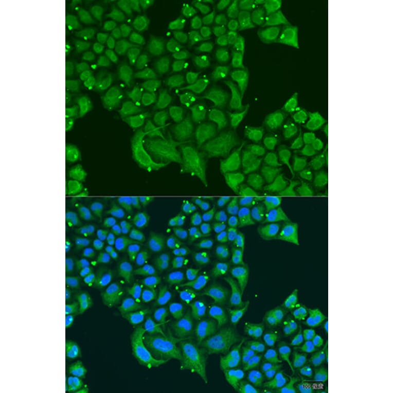 Immunofluorescence - Anti-ATPase Inhibitory Factor 1/IF1 Antibody (A11808) - Antibodies.com