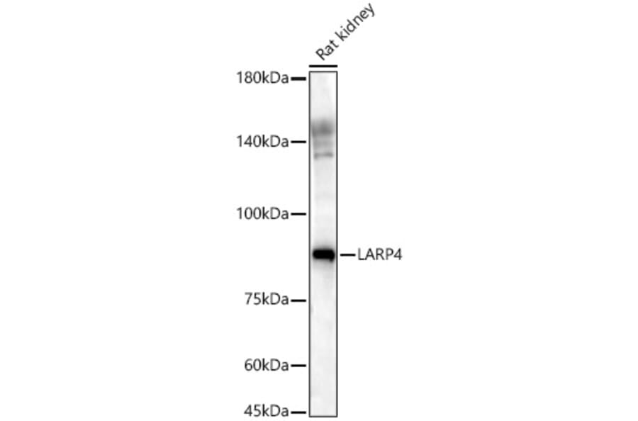 Western Blot - Anti-LARP4 Antibody (A11809) - Antibodies.com