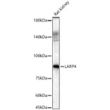 Western Blot - Anti-LARP4 Antibody (A11809) - Antibodies.com
