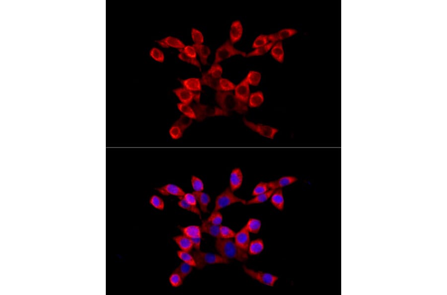 Immunofluorescence - Anti-LARP4 Antibody (A11809) - Antibodies.com
