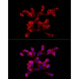Immunofluorescence - Anti-LARP4 Antibody (A11809) - Antibodies.com