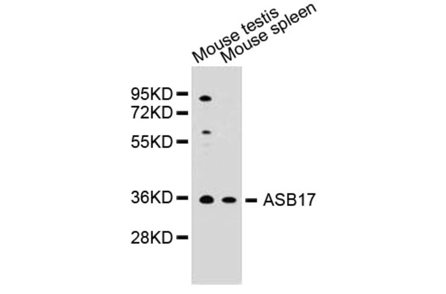 Western Blot - Anti-ASB17 Antibody (A5136) - Antibodies.com