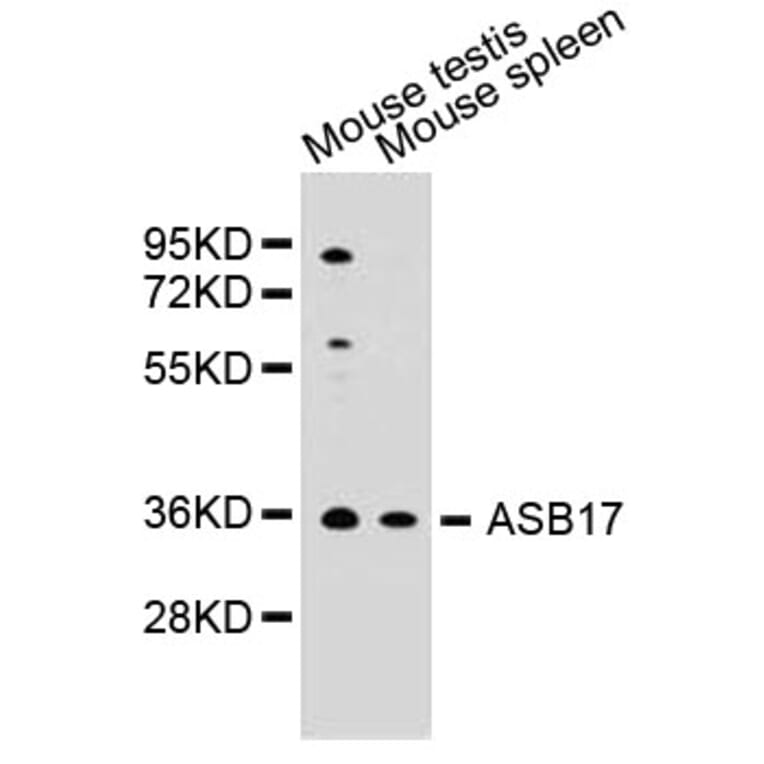 Western Blot - Anti-ASB17 Antibody (A5136) - Antibodies.com