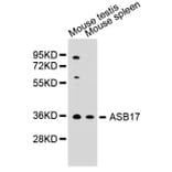 Western Blot - Anti-ASB17 Antibody (A5136) - Antibodies.com