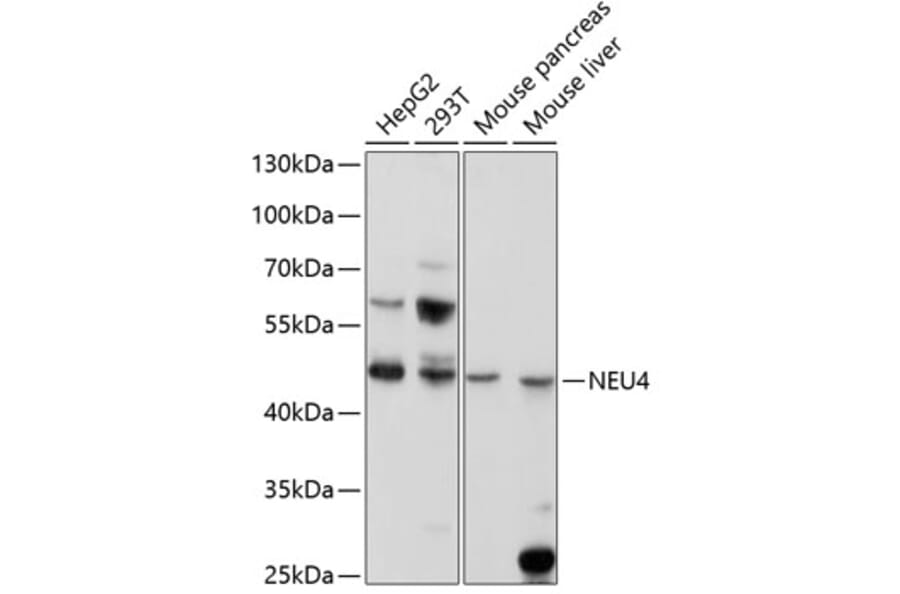 Western Blot - Anti-NEU4 Antibody (A11814) - Antibodies.com