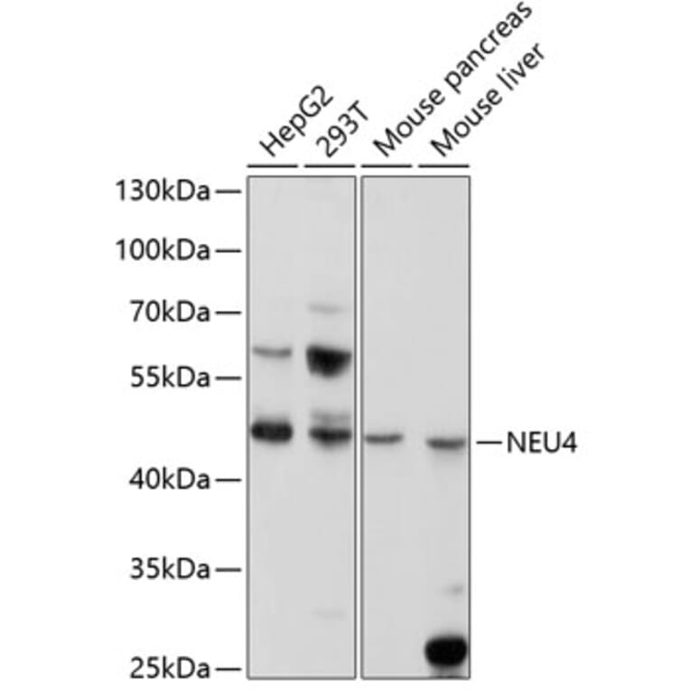 Western Blot - Anti-NEU4 Antibody (A11814) - Antibodies.com
