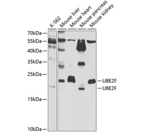 Western Blot - Anti-UBE2F Antibody (A5160) - Antibodies.com