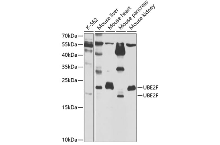 Western Blot - Anti-UBE2F Antibody (A5160) - Antibodies.com