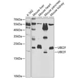 Western Blot - Anti-UBE2F Antibody (A5160) - Antibodies.com