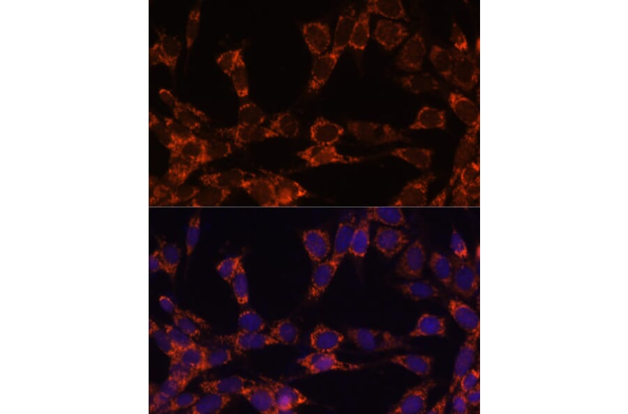 Immunofluorescence - Anti-UBE2F Antibody (A5160) - Antibodies.com