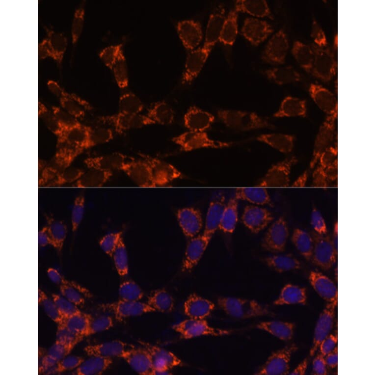 Immunofluorescence - Anti-UBE2F Antibody (A5160) - Antibodies.com