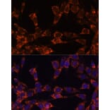 Immunofluorescence - Anti-UBE2F Antibody (A5160) - Antibodies.com