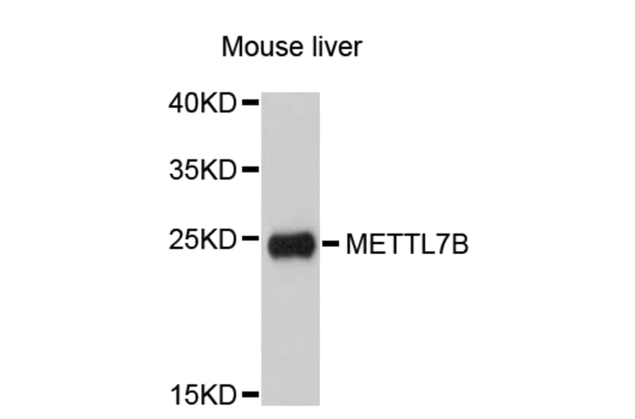 Western Blot - Anti-METTL7B Antibody (A5193) - Antibodies.com