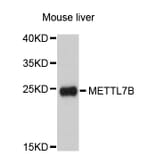 Western Blot - Anti-METTL7B Antibody (A5193) - Antibodies.com