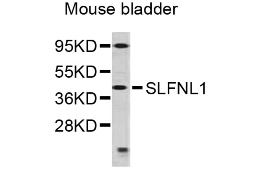 Western Blot - Anti-SLFNL1 Antibody (A5198) - Antibodies.com