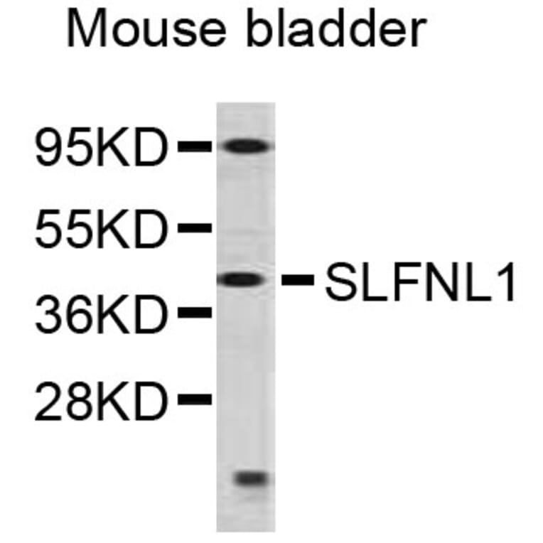 Western Blot - Anti-SLFNL1 Antibody (A5198) - Antibodies.com