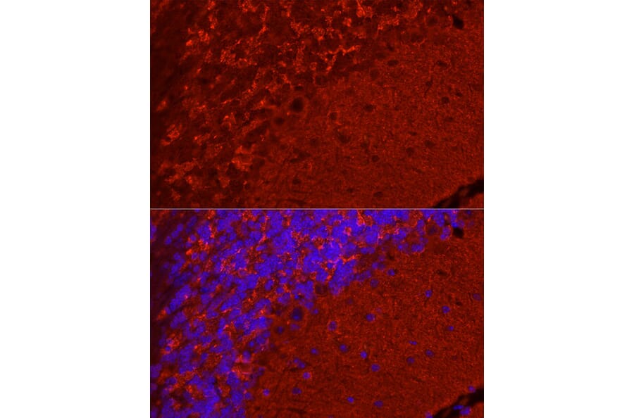Immunofluorescence - Anti-Synapsin I Antibody (A11819) - Antibodies.com