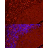 Immunofluorescence - Anti-Synapsin I Antibody (A11819) - Antibodies.com