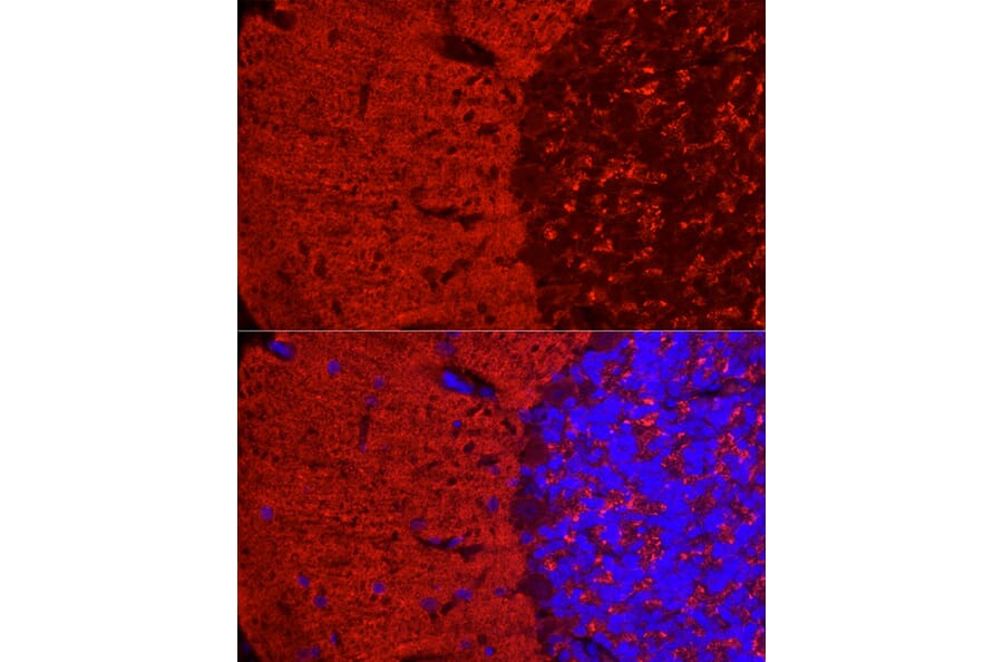 Immunofluorescence - Anti-Synapsin I Antibody (A11819) - Antibodies.com