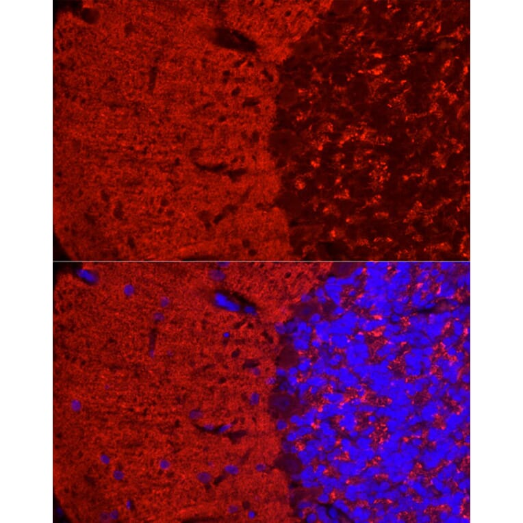 Immunofluorescence - Anti-Synapsin I Antibody (A11819) - Antibodies.com