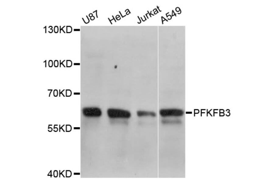 Western Blot - Anti-PFKFB3 Antibody (A5262) - Antibodies.com
