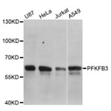Western Blot - Anti-PFKFB3 Antibody (A5262) - Antibodies.com