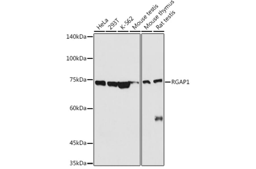 Western Blot - Anti-RACGAP1/MGCRACGAP Antibody (A11823) - Antibodies.com
