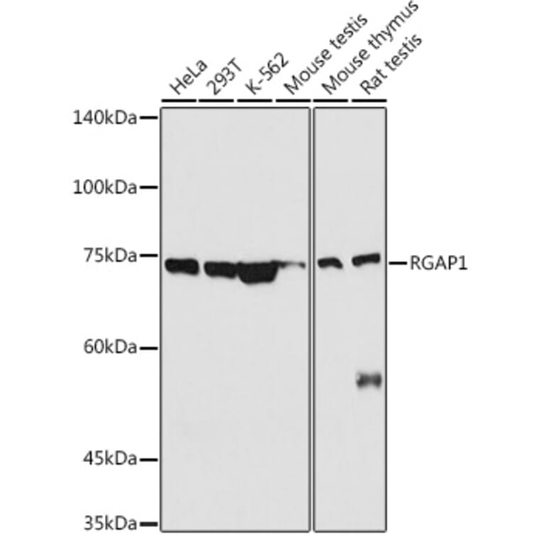 Western Blot - Anti-RACGAP1/MGCRACGAP Antibody (A11823) - Antibodies.com