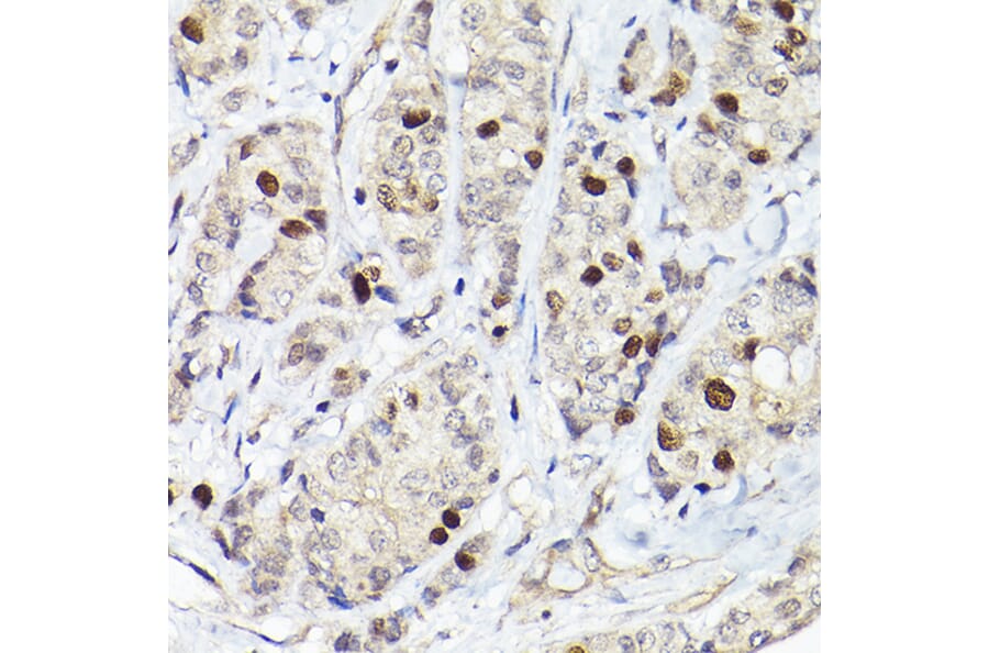 Immunohistochemistry - Anti-RACGAP1/MGCRACGAP Antibody (A11823) - Antibodies.com