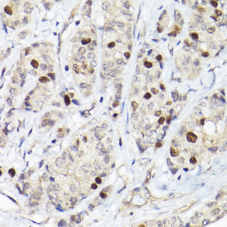 Immunohistochemistry - Anti-RACGAP1/MGCRACGAP Antibody (A11823) - Antibodies.com