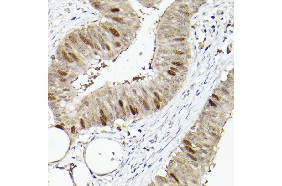 Immunohistochemistry - Anti-RACGAP1/MGCRACGAP Antibody (A11823) - Antibodies.com