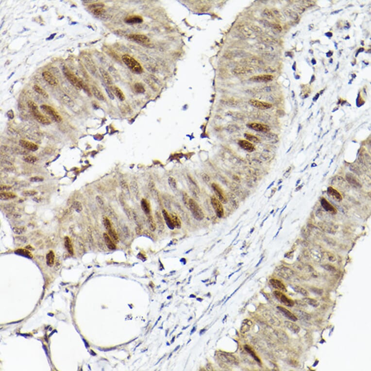 Immunohistochemistry - Anti-RACGAP1/MGCRACGAP Antibody (A11823) - Antibodies.com