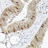 Immunohistochemistry - Anti-RACGAP1/MGCRACGAP Antibody (A11823) - Antibodies.com
