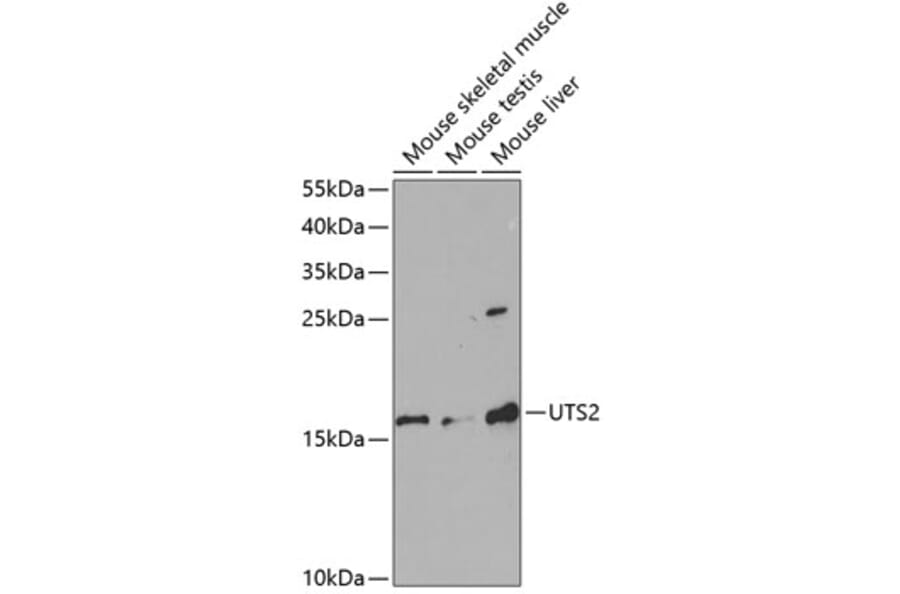 Western Blot - Anti-Urotensin II Antibody (A11824) - Antibodies.com
