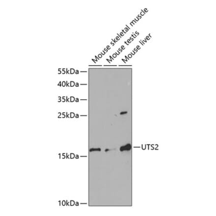 Western Blot - Anti-Urotensin II Antibody (A11824) - Antibodies.com