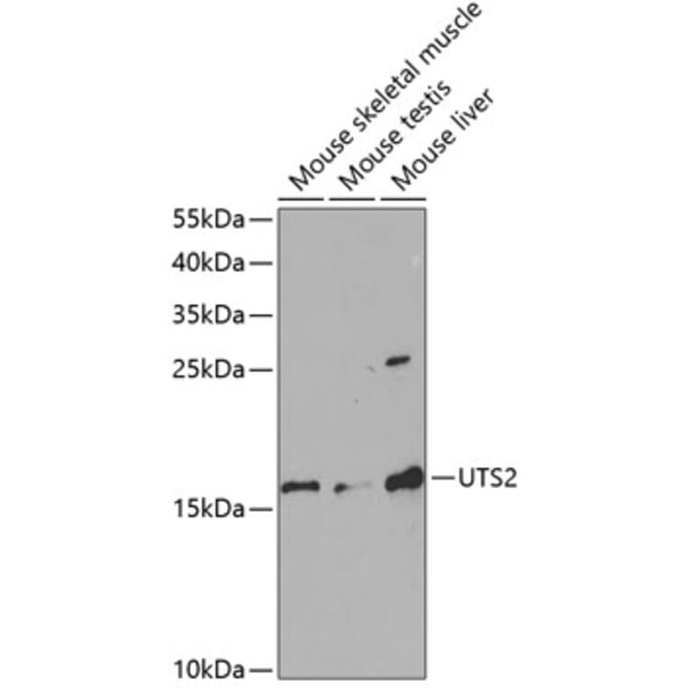 Western Blot - Anti-Urotensin II Antibody (A11824) - Antibodies.com
